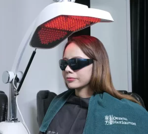 hair loss treatment