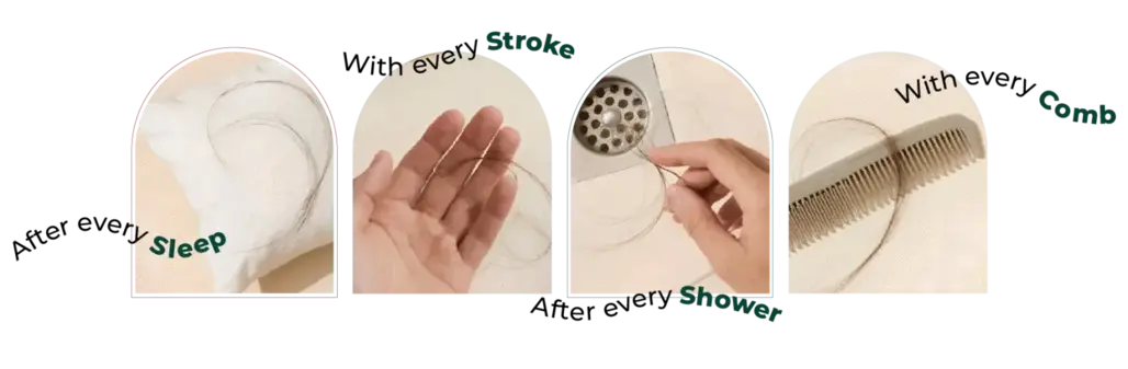 Concerning-Hair-Loss