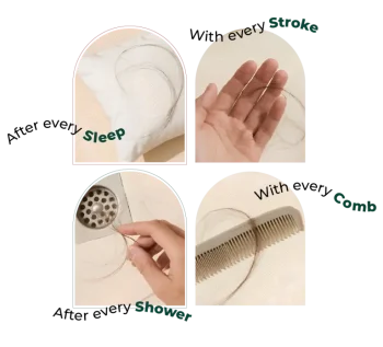 Concerning-Hair-Loss_2001-768x697